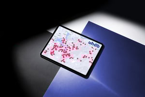 Kontextuelles-Targeting-Uhoo